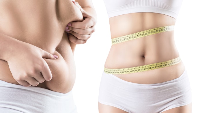 Woman getting body slimming treatment