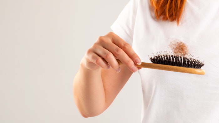 Woman dealing with hair loss