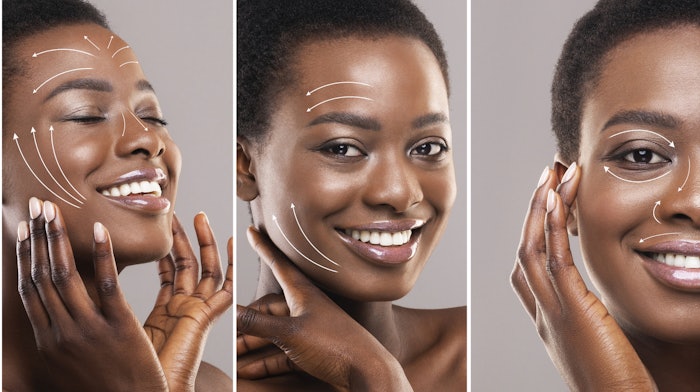 Happy woman after aesthetic treatment