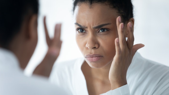 Woman frowning and looking at wrinkles