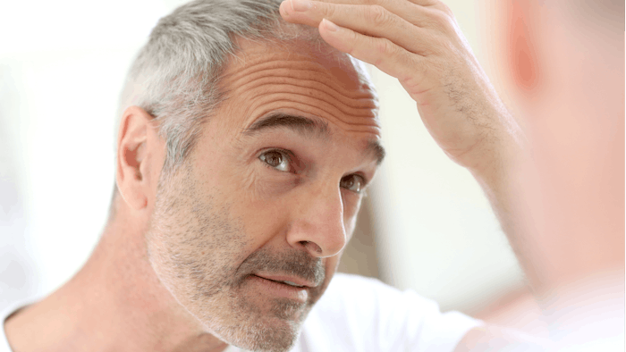 PRP + Platelet Gel Increase Hair Density and Thickness | MedEsthetics