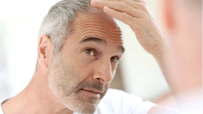 The combination of PRP and platelet gel increased hair density and thickness following three treatment sessions.