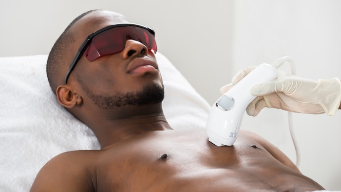 Black man receiving laser hair removal treatment on chest.