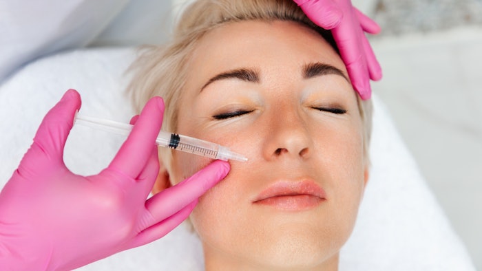 Woman receiving a filler injection to the nasolabial folds.
