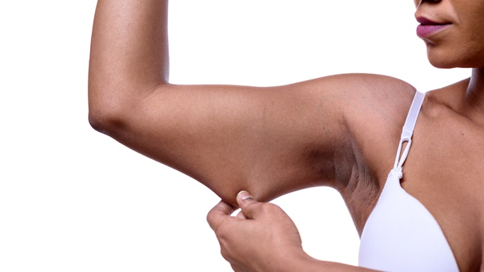 Arm contouring