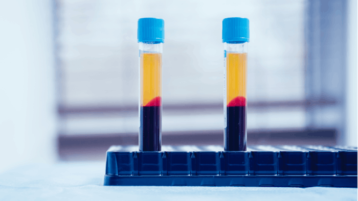 Platelet-rich Plasma