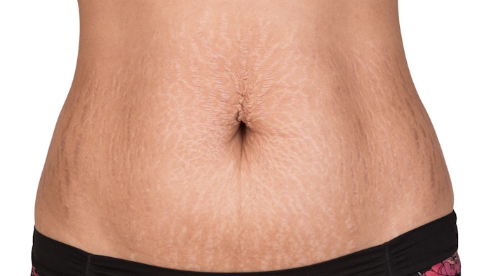 A May 2022 study found that combining topical β-glucan and NAFL treatments showed the greatest aesthetic improvements.