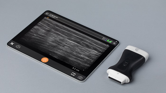 Following the news of the 90-day order, Florida plastic surgeons are turning to alternative devices to comply with the board's ruling, including the Clarius L7 HD3 wireless scanner.
