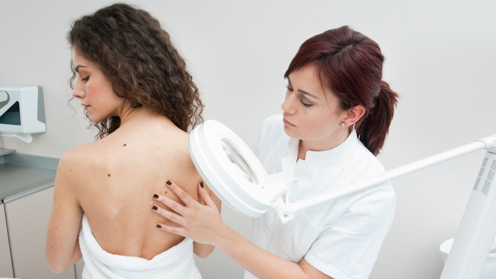 The FDA issued 3 warning letters to companies selling mole and skin tag removal products.