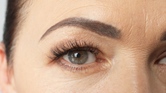 Periorbital rejuvenation was demonstrated to drastically improve observers' perception of aging.