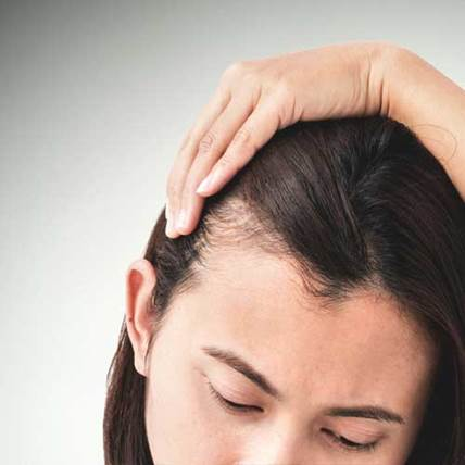 2 Minoxidil Womens Rogaine Hair Growth Medicine For Fuller Hair