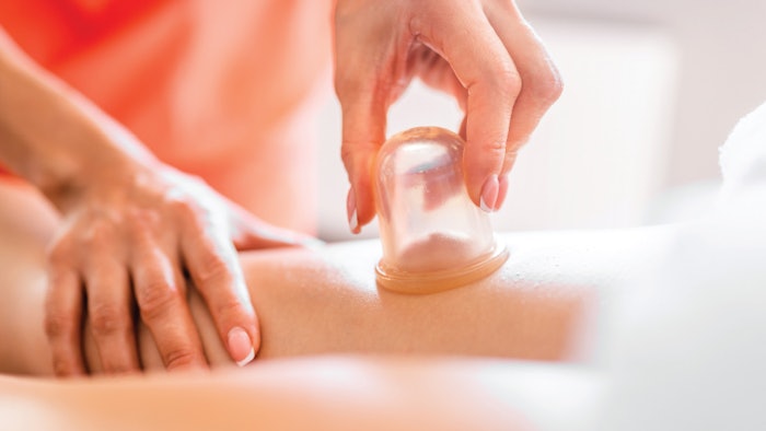 woman performing cupping treatment