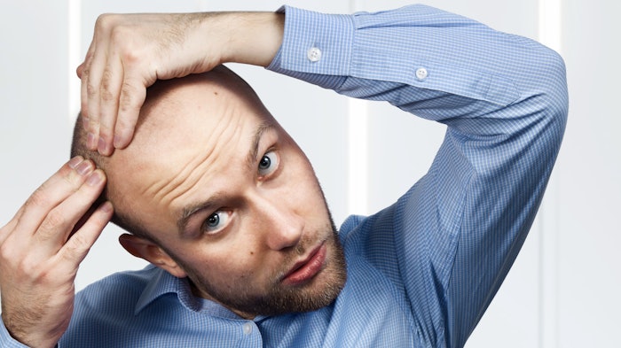 The global hair transplant market is expected to grow at a CAGR of 21.4% and reach $3.35 billion by the year 2030.