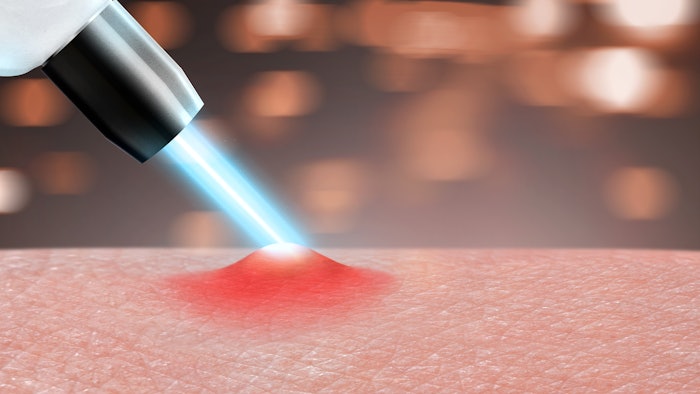 AviClear 12-Month Clinical Data Presented at 42nd Clinical Dermatology Conference