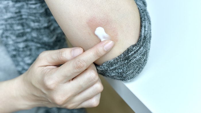 woman using cream on eczema itch