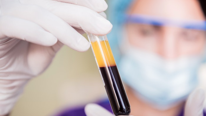 Platelet-rich plasma