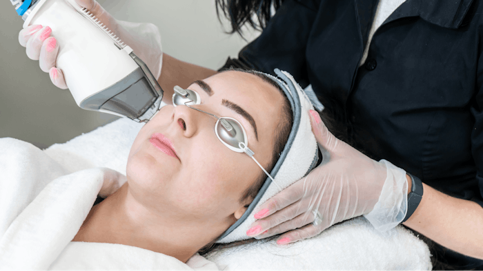 Exosomes derived from stem cells combined with lasers and RF microneedling have shown promising results for acne scar remodeling.