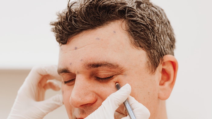 3 Most-Requested Men’s Cosmetic Treatments