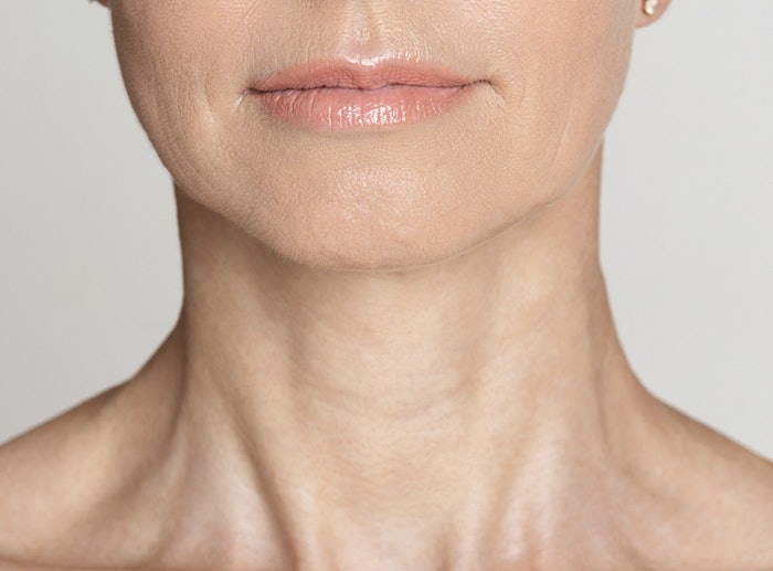 A customized combination of minimally invasive procedures called The Good Energy Lift has shown promising results in neck and jawline rejuvenation.
