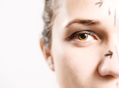 Younger consumers are seeking medical aesthetic benefits, often with a desire for a chiseled, mature or so-called “dissolved” look that contrasts strongly with the filler-obsessed, baby faced looks of the past.