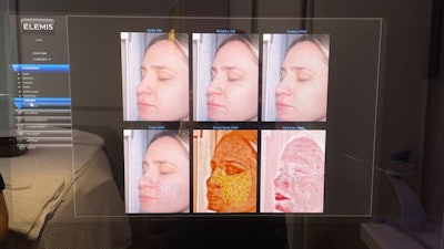 I placed my chin on the Reveal Imager and my profile popped up on the screen. Josirene then walked me through each photo, from sun damage to pore blockage to expression lines (and incoming wrinkles around my eyes and mouth).