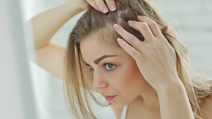 Oral Minoxidil is Gaining Popularity as an Alternative Hair Loss Treatment  | MedEsthetics