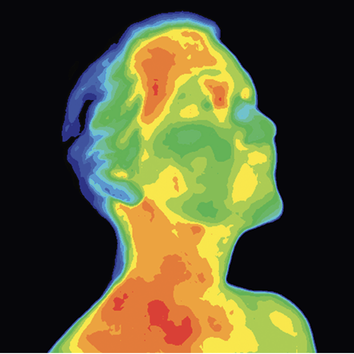 A parallel thought to epidermal exfoliation procedures
