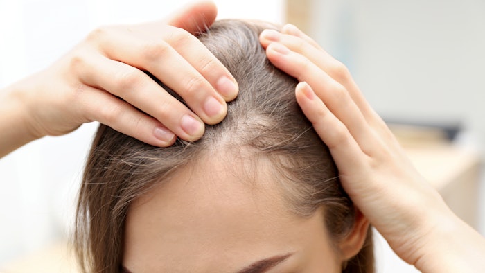 The Connection Between Hair Loss in Women and Various Health Conditions