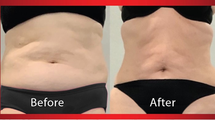 Melissa Morgan's revolutionary fat loss program is based on the fundamentals of healthy eating, exercise, and UltraSlim.