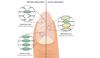 Figure 2 (transparent) Sarah Ostresh L