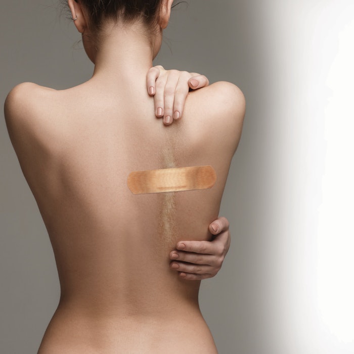 A healthy skin microbiome is vital to the scar healing process.