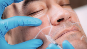 There has been unexpected organic growth in aesthetic medicine due to an increased demand for long-lasting dermal fillers.