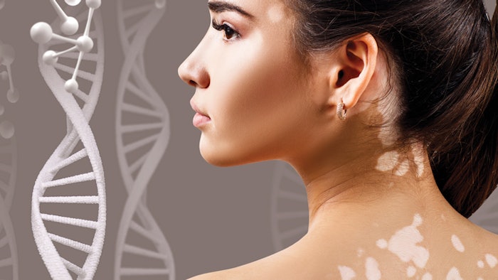How to Choose the Best Ingredients to Treat Pigmentation