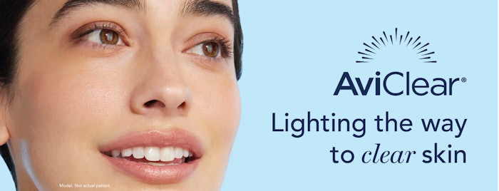 AviClear by Cutera is the first and original FDA-cleared energy-based device for the treatment of mild, moderate, and severe acne