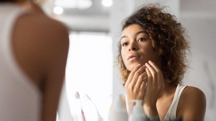 Approximately 85% of all Americans will experience acne in their lifetimes.