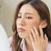 Woman with acne on her face