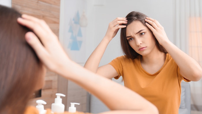 woman with hair loss alopecia