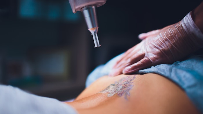 According to a new report by Advanced Dermatology divulging American’s biggest tattoo regrets in 2023, 1 in 4 people have a tattoo they regret getting.