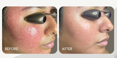 Face Reality 850x425 2