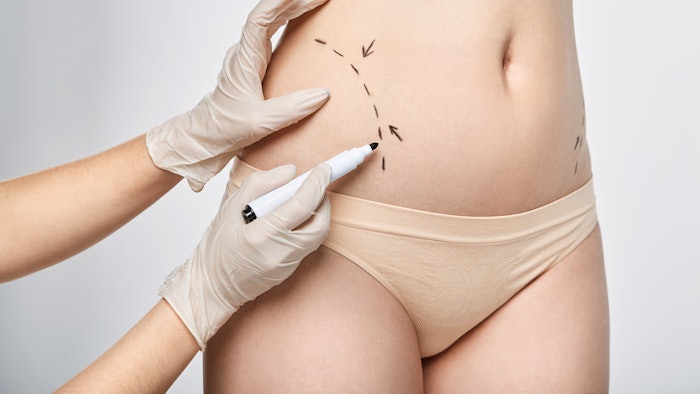 model being evaluated for body contouring plastic surgery