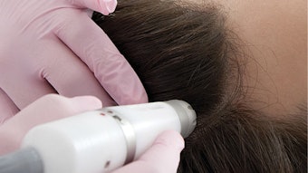 Hair restoration is a growing trend, attracting a larger customer base each year.