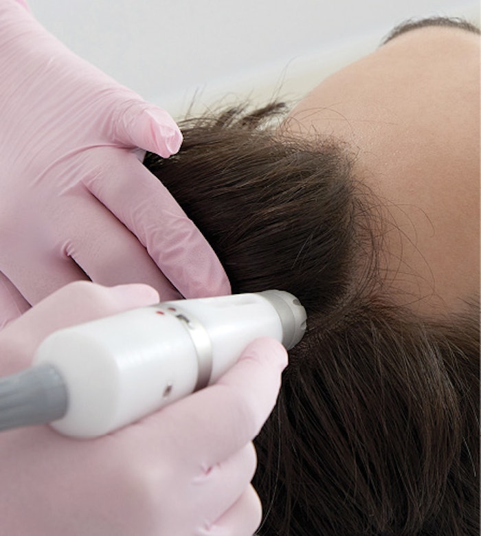 Hair restoration is a growing trend, attracting a larger customer base each year.