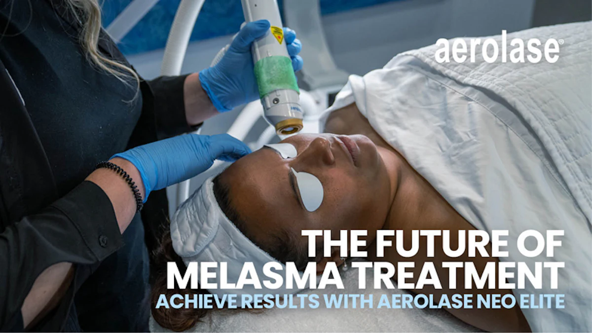 The Future of Melasma Treatment: Achieve Results with Aerolase Neo ...