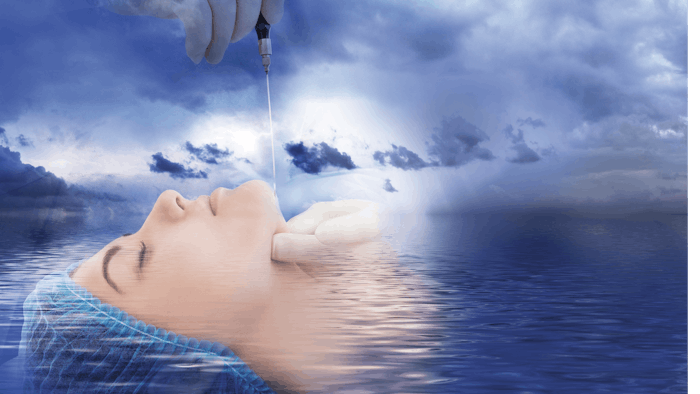 procedure for laser lipolysis of the chin or laser liposuction