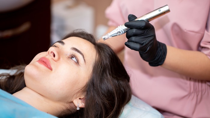 Treatment of the scalp for hair loss, alopecia. A trichologist doctor makes a dermapen procedure on the patient's head.