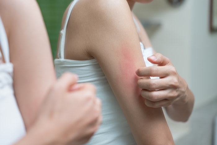 New research points to a signaling pathway that could explain many cases of itchiness on skin.
