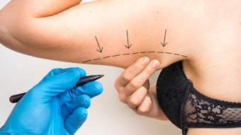 70% of readers are experiencing an increased demand for menopause related treatments! Here are ten ways to incorporate menopause related treatments in your aesthetic practice or medspa.