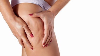 Woman squeezing her thigh to show cellulite