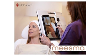 Foto Finder Meesma (2)