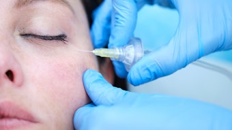 facial carboxytherapy treatment